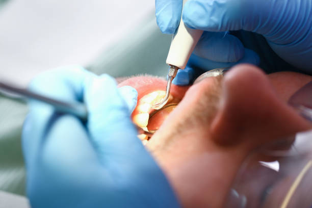 Best Emergency Dental Care for Trauma or Injury in Crisfield, MD